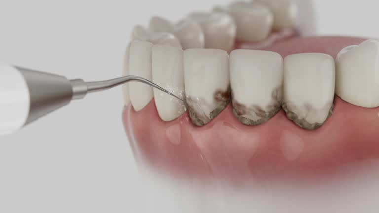 Reliable Dental Implants contractor in Keedysville, MD by Smile Center Dentistry